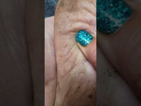 Just Soles. A Tour Of The Barefoot Soles Of My Feet. Barefoot Farming.