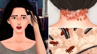 ماهو قمل الرأس؟! وكيف يتم التخلص منة_What is head lice?