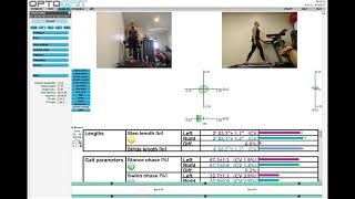 N. Fleuren Treadmill Walking 3Mph For 30 Seconds 09122019