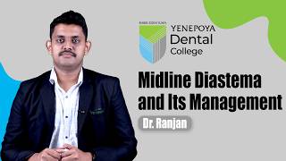 Midline Diastema and Its Management | Conservative Dentistry &amp; Endodontics | Yenepoya Dental College