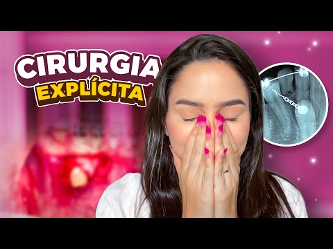 Vídeo: A cirurgia canina impactada dói?