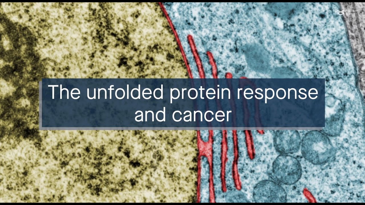 Targeting the unfolded protein response to treat cancer - YouTube