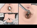 Asmr animation removing huge navel stone  real sound  tingle