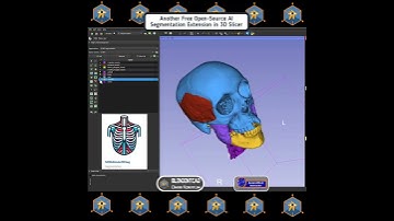 MONAIAuto3DSeg Artifical Intelligence Extension in 3D Slicer Segmentation