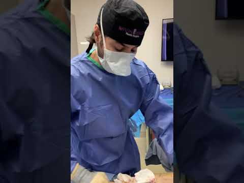 Rapid Recovery Breast Augmentation testimonial