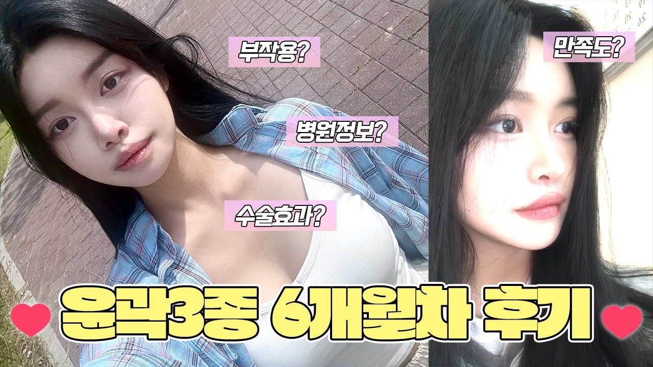 보정 없이❤️ 이 정도 자연스러움의 끝판왕!!👉윤곽3종 6개월차👈