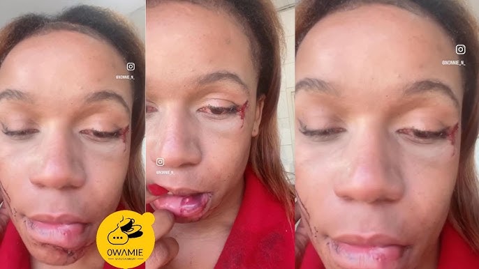 Dr Pert Passes And Her Younger Sister Eposes She Stole Her Inheritance To Start Her Clinic - YouTube