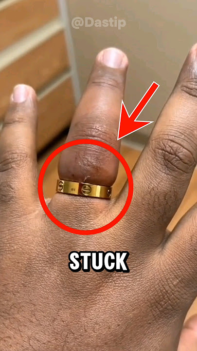 how to remove a ring stuck on finger