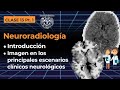 13.1 -  Neuroradiología: Introducción y métodos de imagen en los principales escenarios clínicos