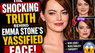 The Shocking Truth Behind Emma Stone's Yassified Face