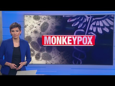 Monkeypox cases rising in Chicago, city's top doctor warns