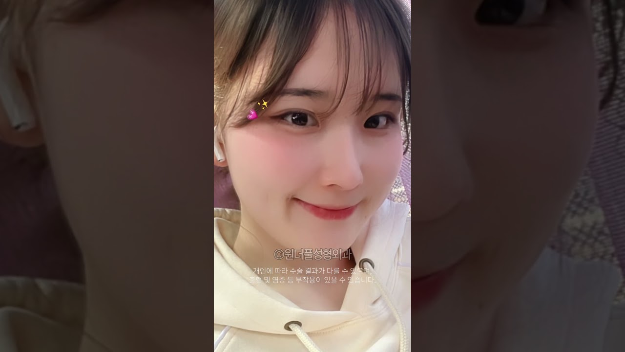 [Гайхамшигтай гоо сайхны мэс заслын эмнэлэг] Нүдээ нээгээд зураг авахуулахыг хүсэж байна #давхарзовхины_мэсзаслын_сэтгэгдэл