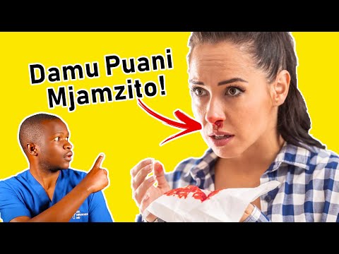 Video: Kuvuja damu kwa upandaji huanza lini?