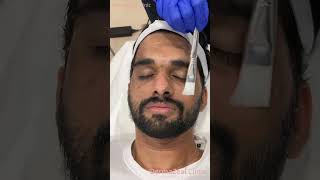 Hydra Facial Dermazeal Clinic Bangalore