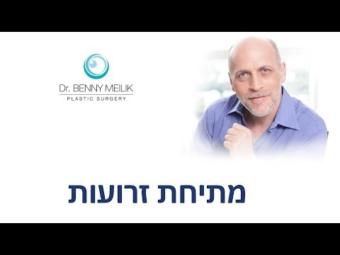 ניתוח למתיחת זרועות מדוללות - ד"ר בני מייליק