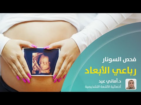 السونار رباعي الأبعاد مع د أماني عيد مجمع أصداء الصحة