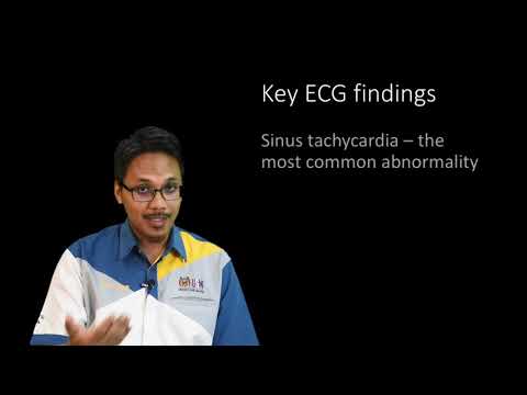 Common ECG in