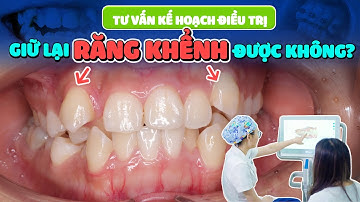 Niềng Răng Có Giữ Lại Răng Khểnh Được Không? Chỉ 1 Phút Đầu Video Có Ngay Câu Trả Lời Chi Tiết Nhất