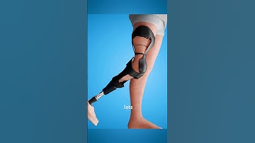 Rotationplasty Procedure 3D Animation #rotationplasty #rotationplastyawareness    #facts