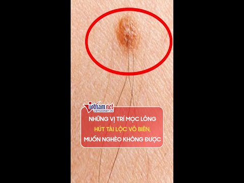 Video Những vị trí mọc lông hút tài lộc vô biên, muốn nghèo... - youtube