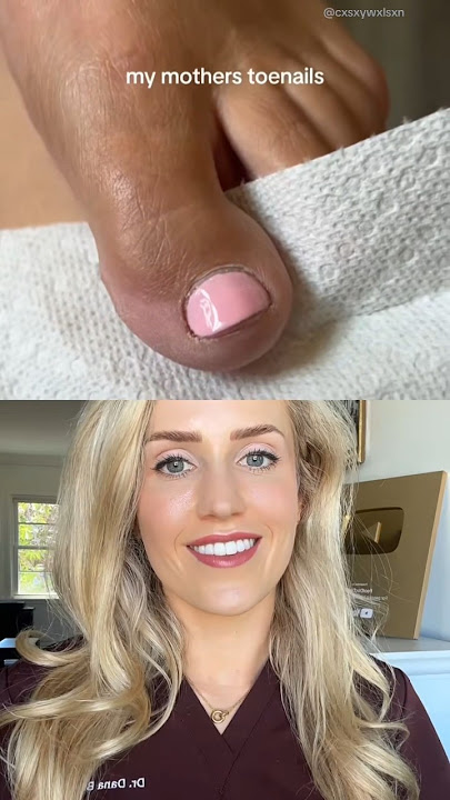 What happened to her toes?!