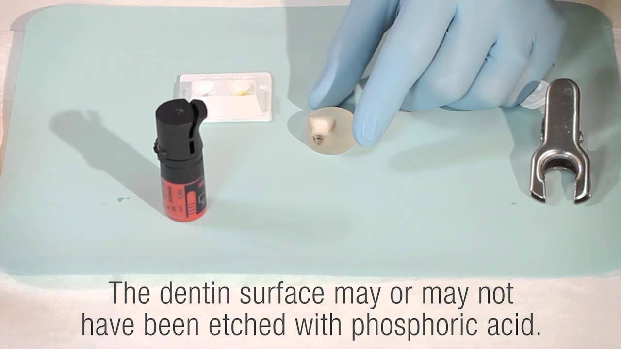 Battle of the Bonds - Scotchbond Universal Adhesive