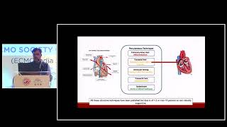 Unloading of Left Ventricle in Peripheral VA ECMO – Dr Niren Bhavar