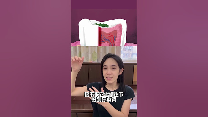 补蛀牙变抽神经？为什么牙医要挖那么大洞＃蛀牙 - 天天要闻
