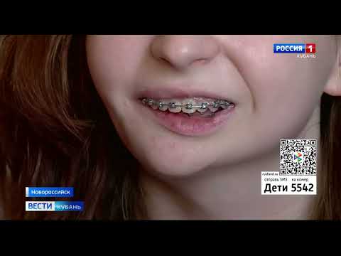 Ира Садовская, 15 лет, синдром 1–2-й жаберных дуг, недоразвитие нижней челюсти