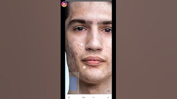 Snapseed Remove face Pimples Tutorial HDR Background Photo #photoediting #snapseed #shotrs #ytshorts