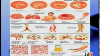 Uefateams.com-il medico risponde... ipertensione arteriosa