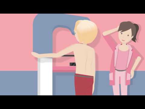 Video: Mammogramm Schmerzen? Wie Es Sich Anfühlt Und Was Sie Danach Erwartet
