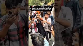 raw news cjp delhi protest 😞😞