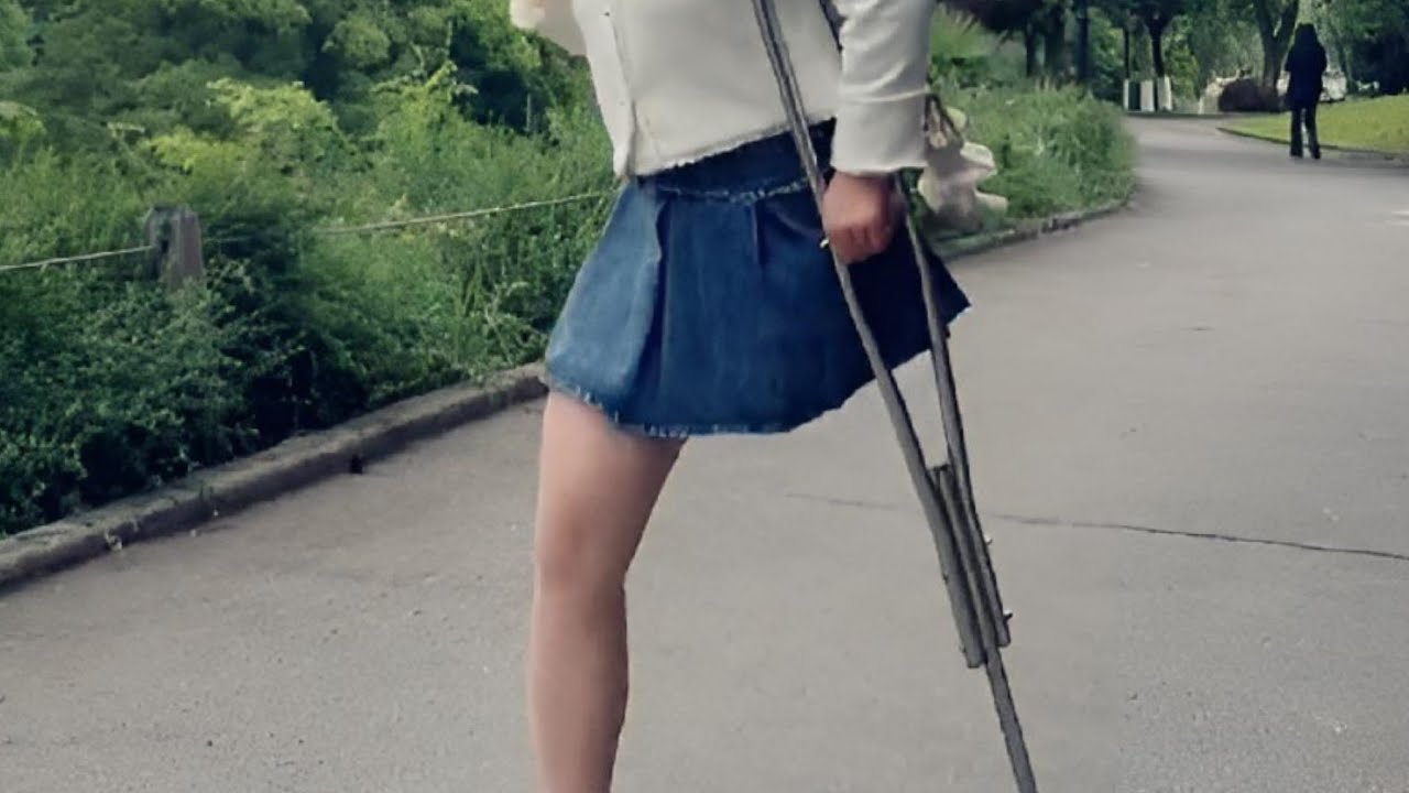 Leg amputee