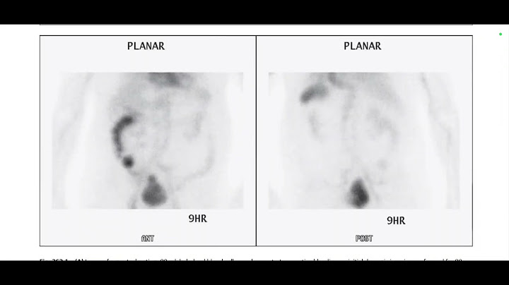 Top 3 differentials in radiology a case review