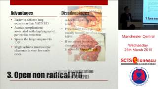 Extended pleurectomy decortication