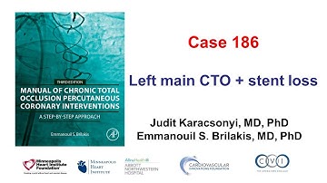 Case 186: Manual of CTO PCI - Left main CTO + stent loss