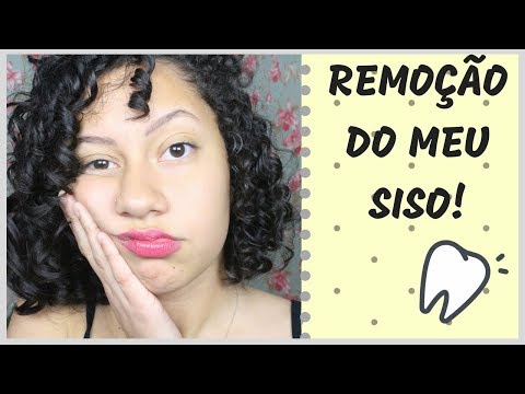 REMOÇÃO DO MEU SISO COM O APARELHO | DOR, PÓS OPERATÓRIO, ALIMENTAÇÃO...