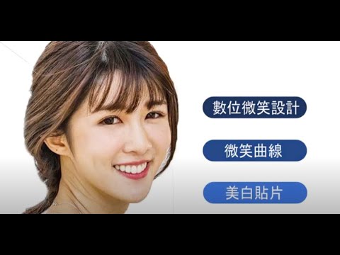 【全瓷美白貼片】 黃女士 DSD數位微笑設計 量身打造的完美笑容