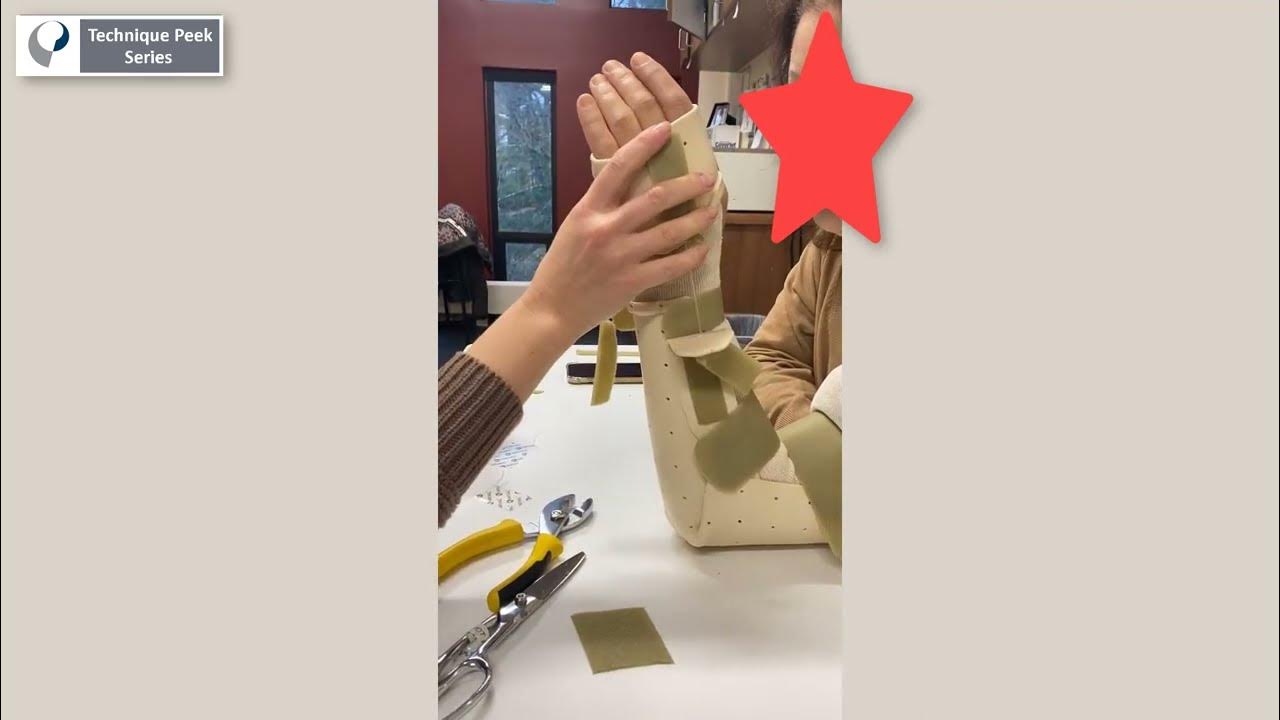 How to create a static progressive wrist flexion extension splint