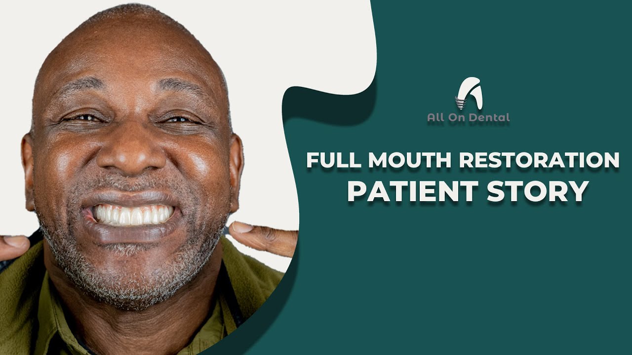 How does it feel to get full mouth restoration? - All On Dental Istanbul