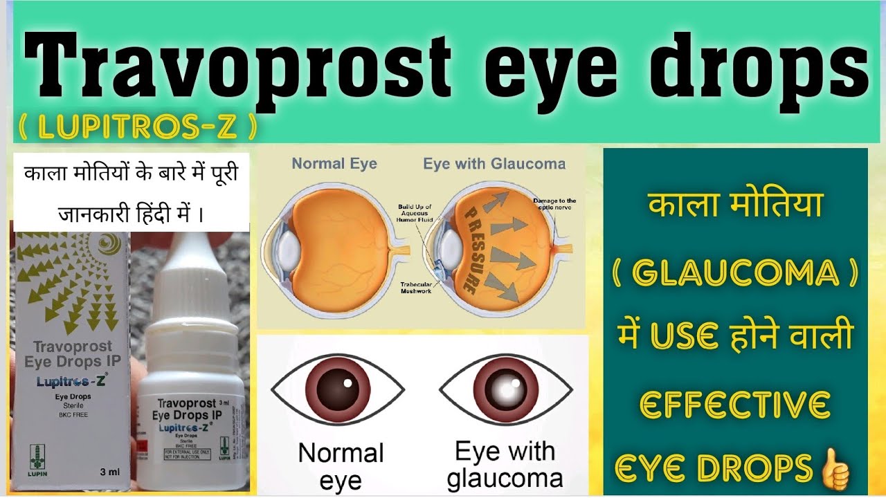 Travoprost eye drops Lupitros eye drop 3ml use,dose,side effects