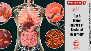Top 5 Major Cause of Bacterial Dysentery | Bacterial Dysentery | Dysentery | Diarrhoea | USA | 2023
