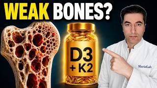 Osteoporosis After 50? Calcium Alone Is Not Enough
