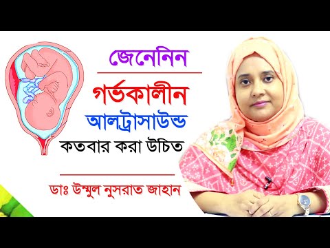 ভিডিও: আর্মেনিয়ান গণহত্যার সংগঠনে ইহুদি শিকড়