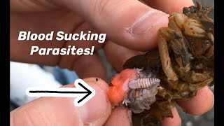 Removing Huge Blood Sucking Parasites part 4 NEW Episode!