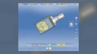 CEREC 4.0: Dr. Todd Ehrlich's beta demo