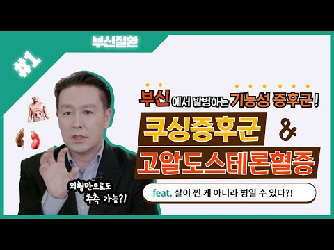 후다닥 명대사 - 부신질환 1탄