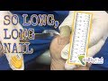 Really Long Nail - First Visit in over a Year!  By Tampa Podiatrist Dr. Binh Nguyen