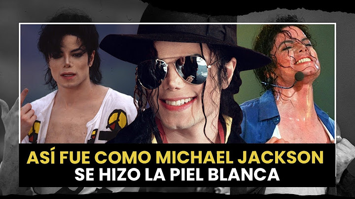 Michael Jackson, por esta razón se hizo la piel blanca - Play Us